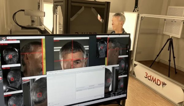 Лицо с 3D-принтера — британец первым в мире получил необычный протез