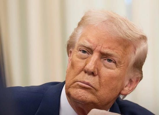 У Трампа виявили хронічну венозну недостатність. Він обстежувався через набряки й синці